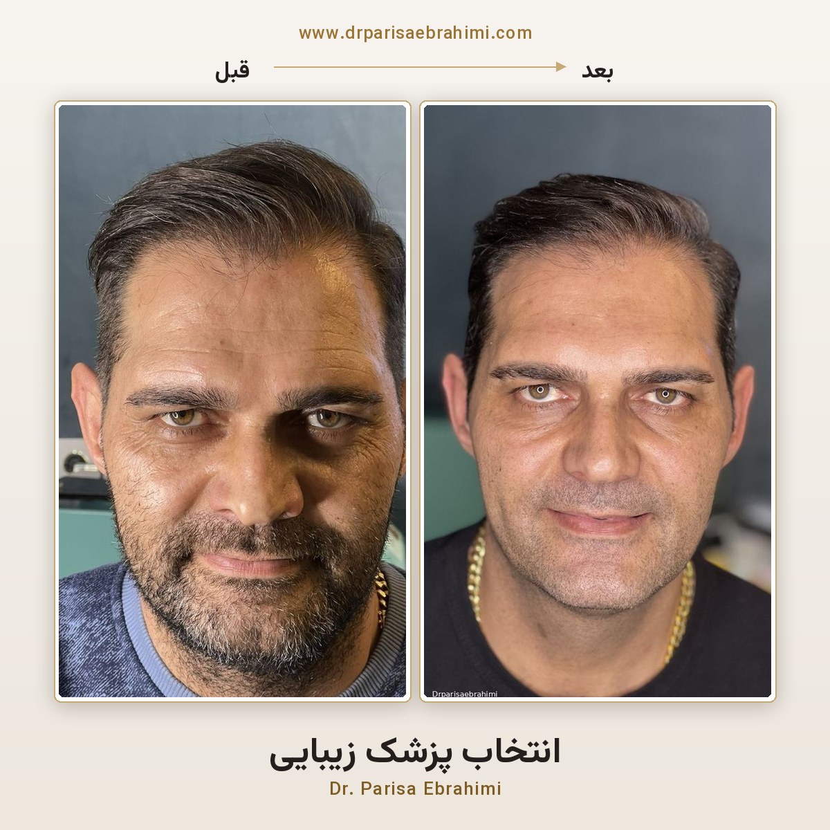 راهنمای انتخاب بهترین پزشک زیبایی در تهران — معیارهای انتخاب پزشک فیلر، بوتاکس و ریزش مو